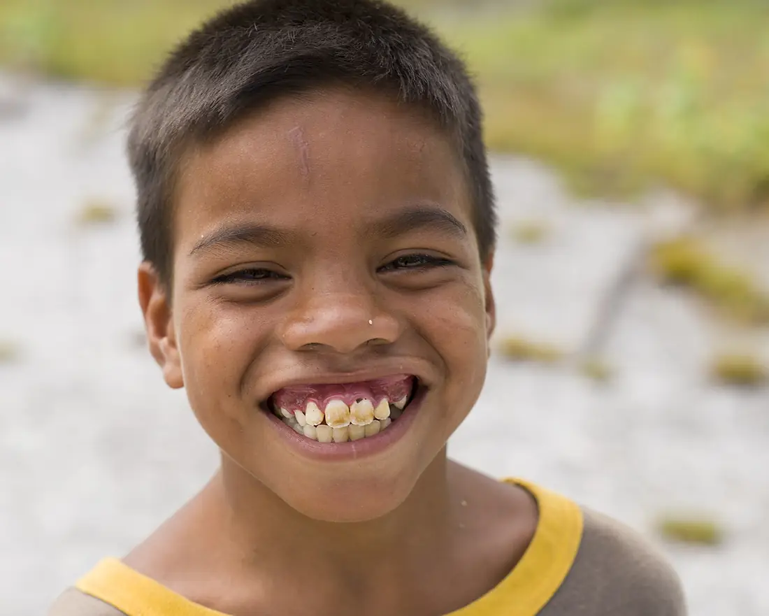 Christmas Island - Kiritimati boy teeth (14337014426)